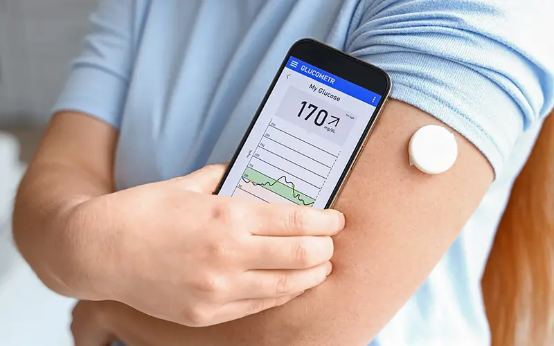 continuous glucose monitor